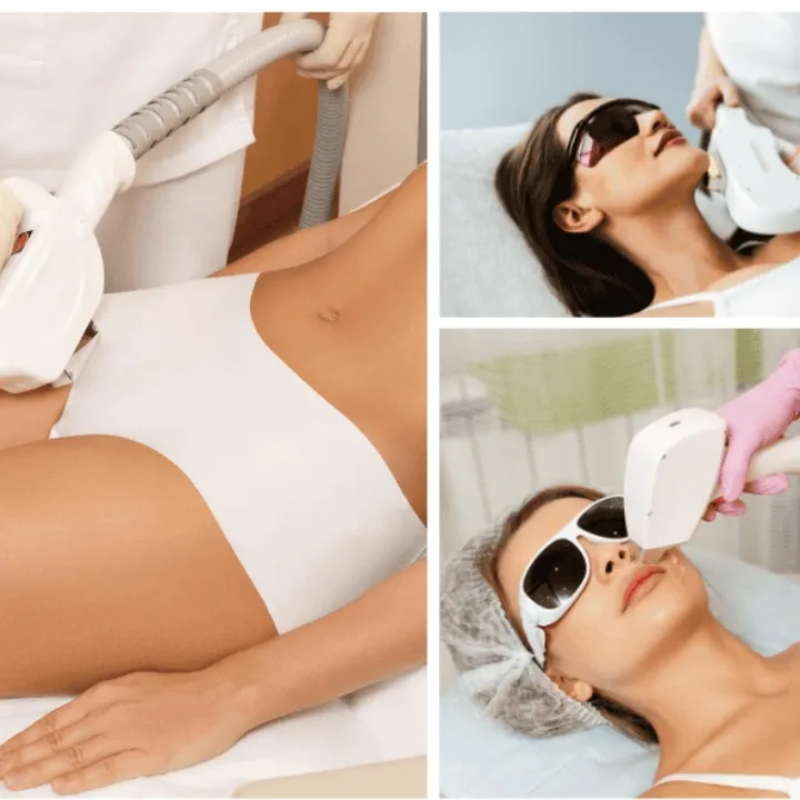 Dauerhafte Haarentfernung Frauen mit Hyperpulse im Kosmetikstudio Easy Beauty Rielasingen bei Singen