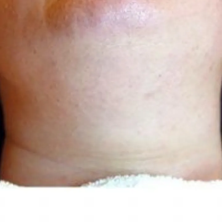 easybeauty_kosmetikstudio_rielasingen_dauerhafte_haarentfernung_frau11