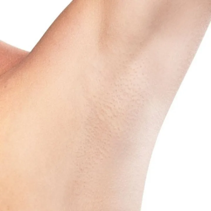 easybeauty_kosmetikstudio_haarentfernung_waxing45
