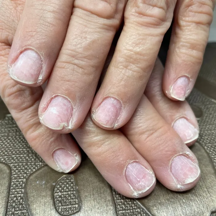 Gelnägel Modellage in Rielasingen bei Singen – Elegantes Nageldesign von Easy Beauty