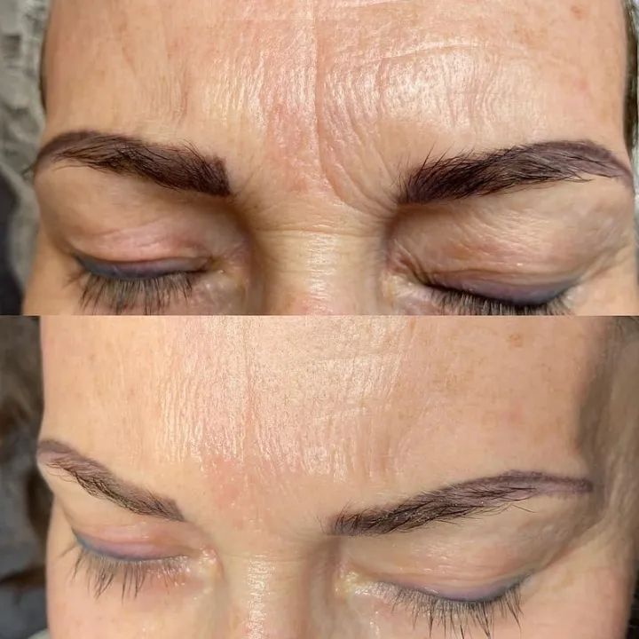 easybeauty_kosmetikstudio_thermo_line_pro_gesicht_hals_hautstraffung8