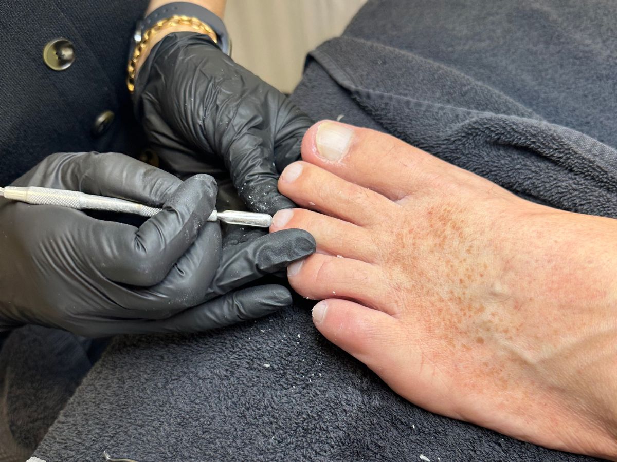 Nagelhaut und Nagelfalz werden bei der Fußpflege gesäubert – Easy Beauty Rielasingen bei Singen