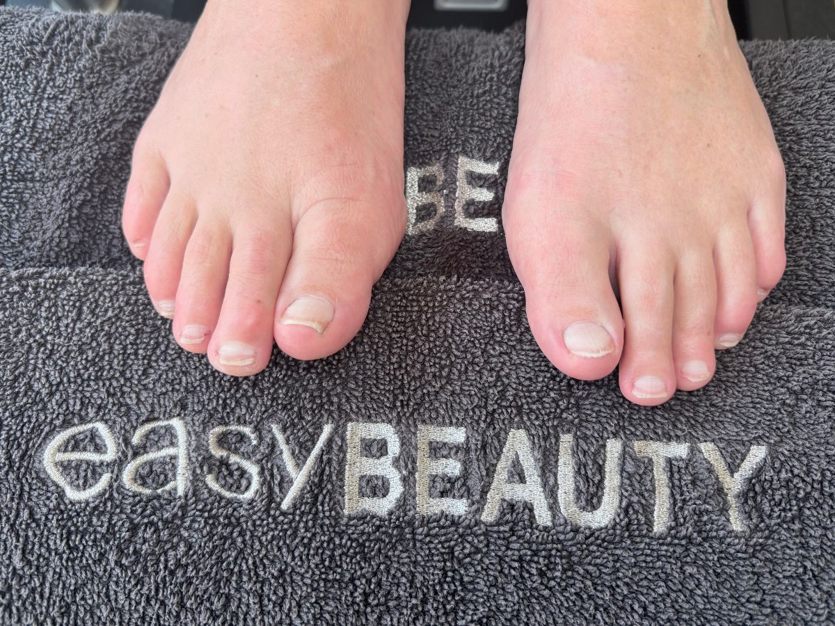 Vorher: ungepflegte Fußnägel mit Lackresten vor der Pediküre bei Easy Beauty Rielasingen
