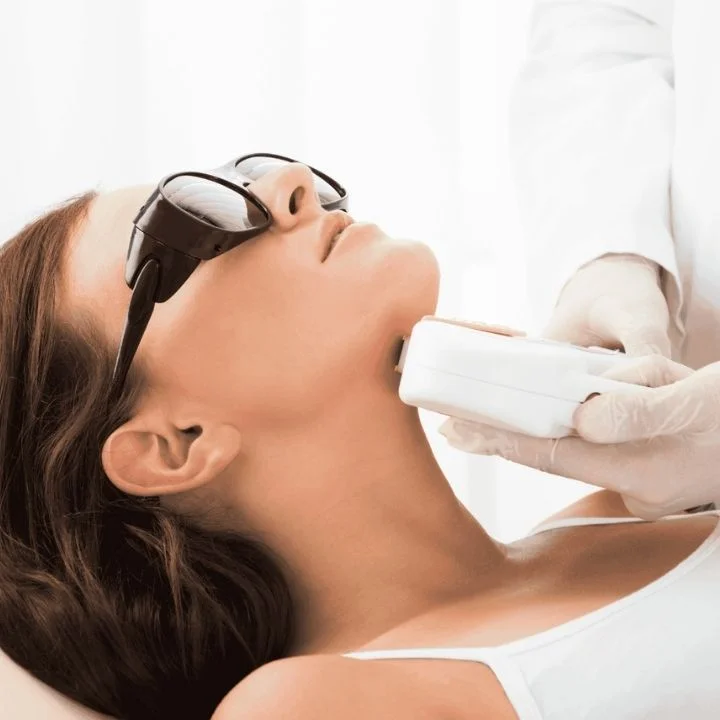 Professionelle Laser-Haarentfernung im Gesichtsbereich mit modernem Laser-Gerät