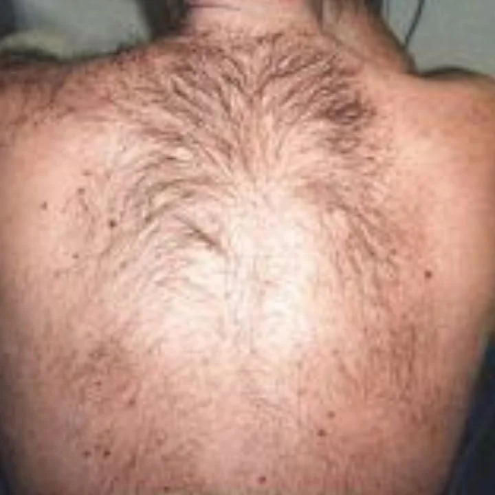 Oberer Rückenbereich mit Schultern und Scapularregion