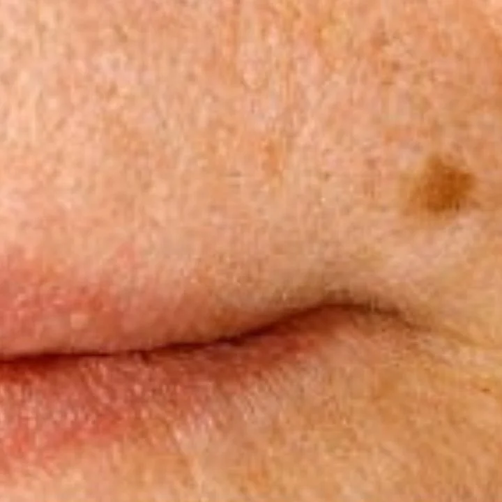 Lippen- und Mundbereich in Nahaufnahme